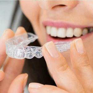 Your Step-by-Step Smile Solution to Invisalign in Annapolis